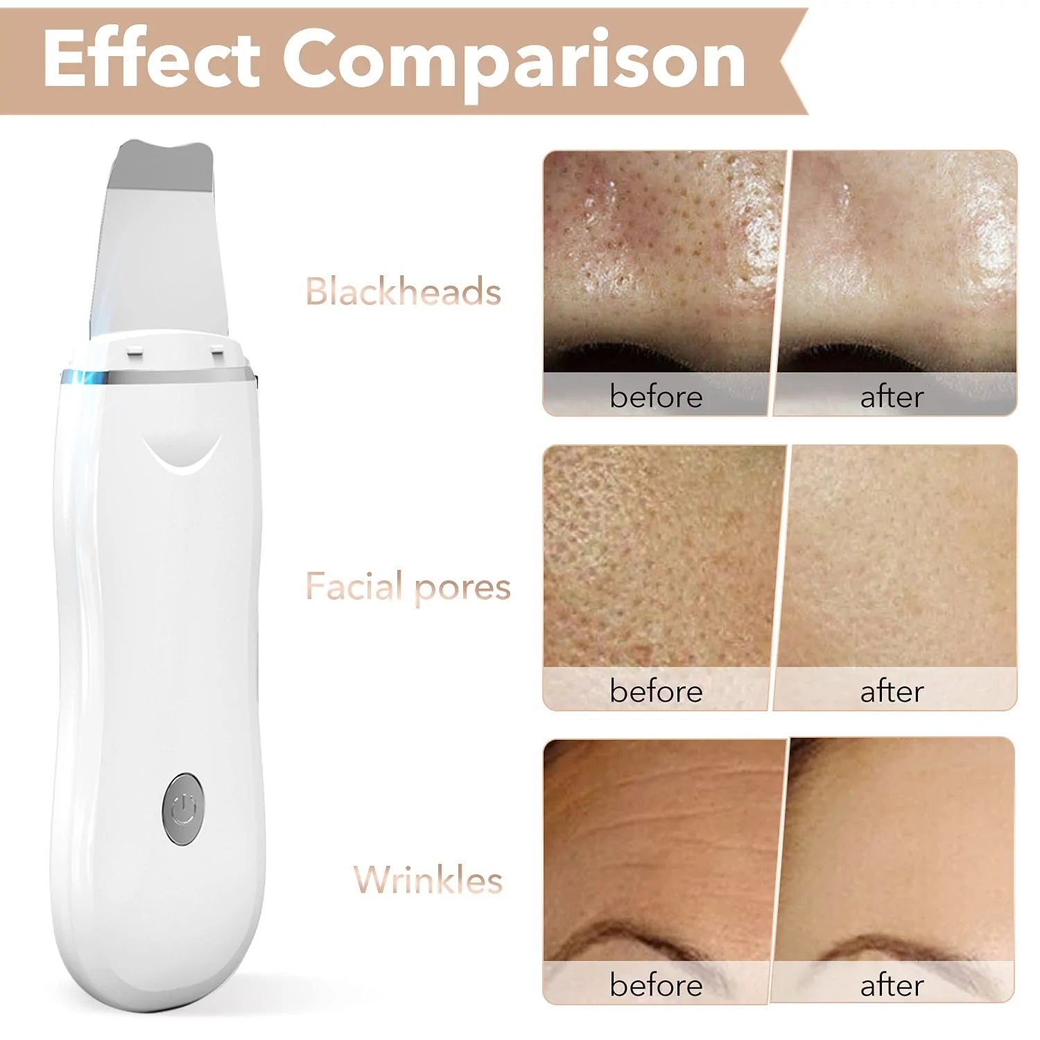 Ultrasonic Skin Scrubber - LegacyAxis