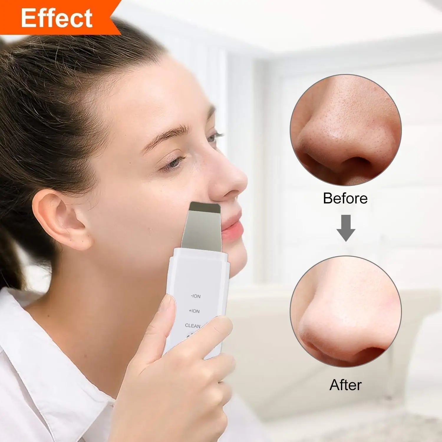 Ultrasonic Skin Scrubber - LegacyAxis